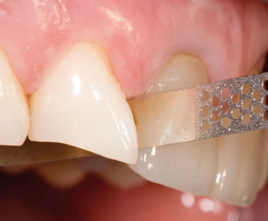 Diamantové pásky-Červená zrnitost, perforované bez pilky 6,0mm